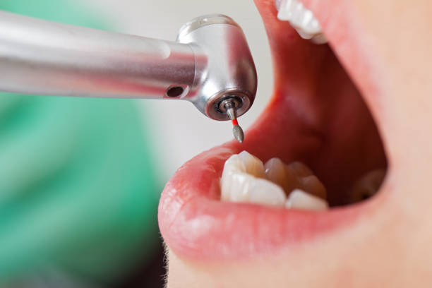 Best Emergency Dental Care for Broken or Chipped Teeth in Heber Overgaard, AZ